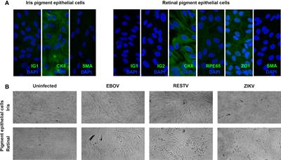 Brief Research Report: Ebola Virus Differentially Infects Human Iris and Retinal Pigment Epithelial Cells